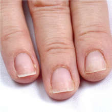 anti-aging-for-hands-ker4